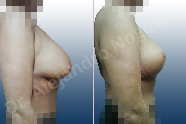 Before & After Case GBEGBFAT