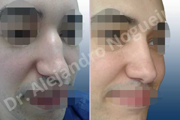 Before & After Case IAJKYWUC