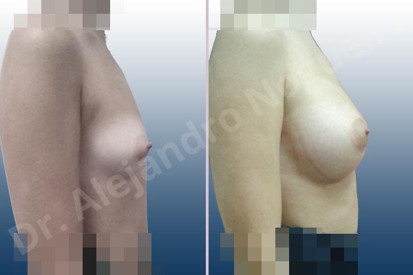 Before & After Case ZCG9TLH8