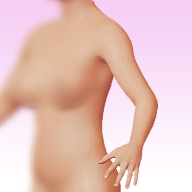 arm left oblique