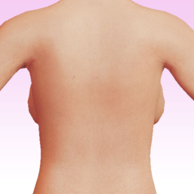 breast rear