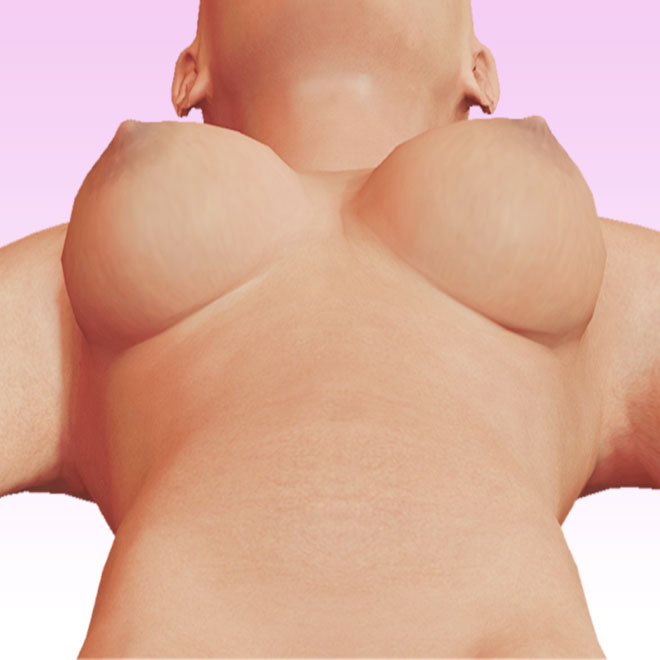 breast worm's eye