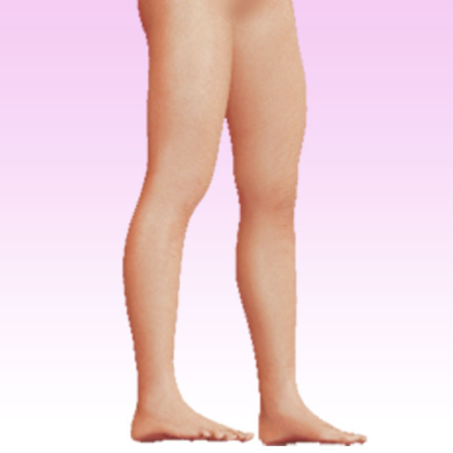 leg right lateral